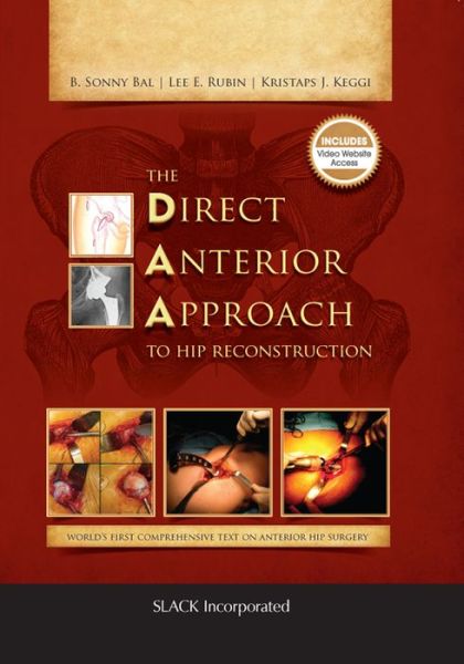 Cover for B. Bal · The Direct Anterior Approach to Hip Reconstruction (Hardcover Book) (2016)