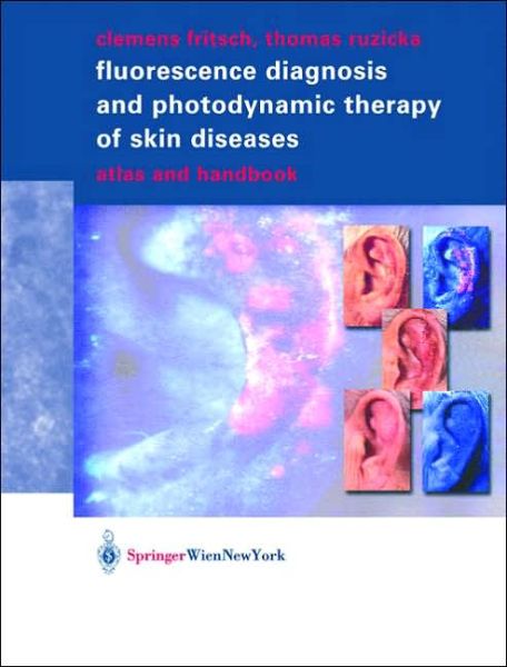 Cover for Clemens Fritsch · Fluorescence Diagnosis and Photodynamic Therapy of Skin Diseases: Atlas and Handbook (Hardcover Book) [2003 edition] (2003)