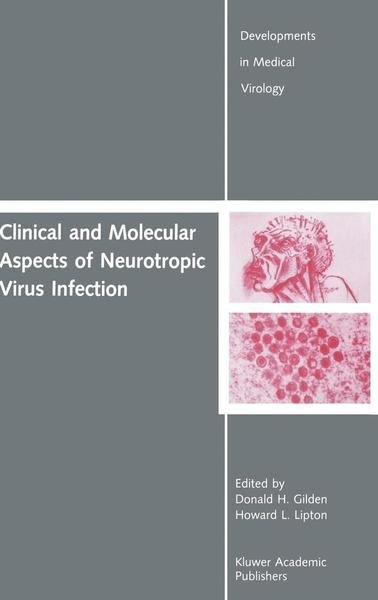 Cover for Donald H Gilden · Clinical and Molecular Aspects of Neurotropic Virus Infection - Developments in Medical Virology (Hardcover bog) [1989 edition] (1989)