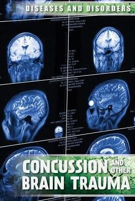 Cover for Ryan Nagelhout · Concussions and Other Brain Trauma (Gebundenes Buch) (2017)