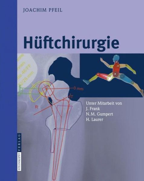 Cover for Joachim Pfeil · Huftchirurgie (Spiral Book) [2008 edition] (2008)