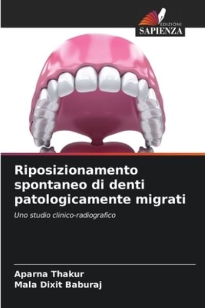 Cover for Aparna Thakur · Riposizionamento spontaneo di denti patologicamente migrati (Paperback Bog) (2021)