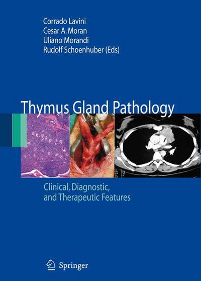 Cover for Thymus Gland Pathology: Clinical, Diagnostic and Therapeutic Features (Paperback Book) [2008 edition] (2008)