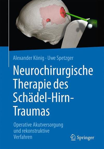 Cover for König · Neurochirurgische Therapie des Schaedel Hirn Traumas (Book) (2019)