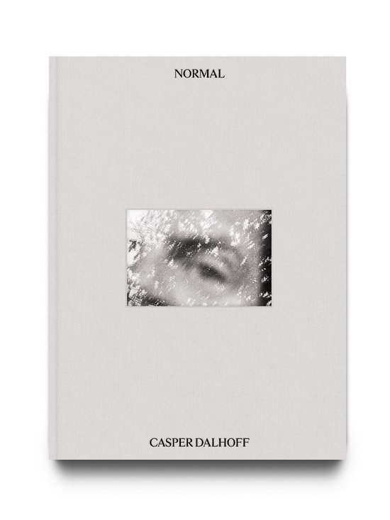 Cover for Casper Dalhoff · Normal (Hardcover Book) [1. wydanie] (2024)