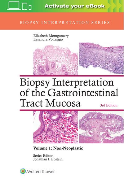 Biopsy Interpretation of the Gastrointestinal Tract Mucosa: Volume 1: Non-Neoplastic - Biopsy Interpretation Series - Elizabeth A. Montgomery - Kirjat - Lippincott Williams and Wilkins - 9781496337276 - lauantai 16. syyskuuta 2017
