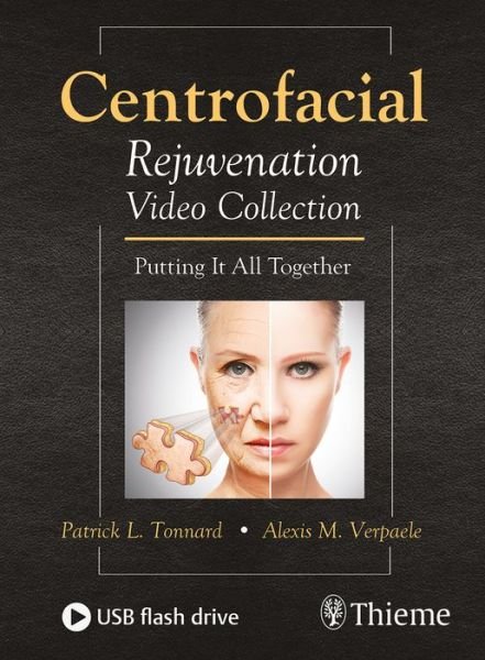 Centrofacial Rejuvenation Video Collection: Putting It All Together - Tonnard, Patrick, MD - Andet - Thieme Medical Publishers Inc - 9781684200276 - 25. januar 2018