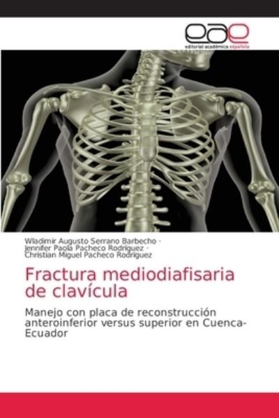 Cover for Wladimir Augusto Serrano Barbecho · Fractura mediodiafisaria de clavícula (Paperback Book) (2021)
