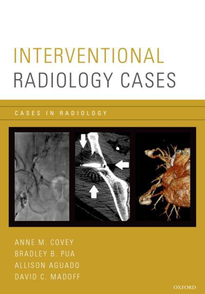 Interventional Radiology Cases - Cases In Radiology - Covey, Anne M. (Associate Professor of Radiology, Division of Interventional Radiology, Associate Professor of Radiology, Division of Interventional Radiology, Memorial Sloan-Kettering Cancer Center and Weill Cornell Medical College, New York, New York, U - Bøger - Oxford University Press Inc - 9780199331277 - 5. marts 2015