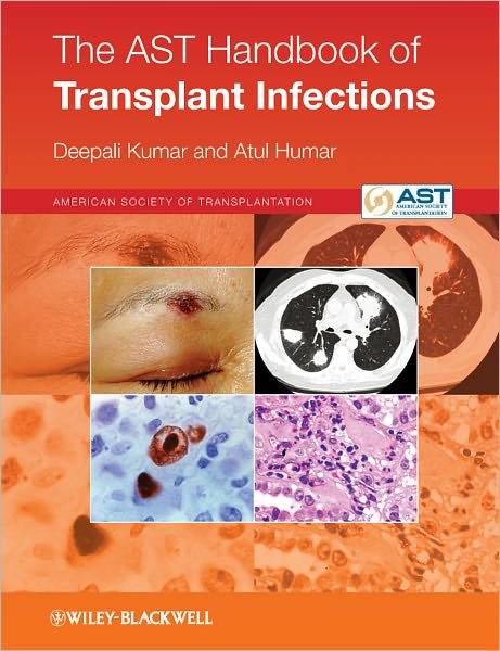 The AST Handbook of Transplant Infections - Kumar, Deepali (University of Alberta) - Books - John Wiley and Sons Ltd - 9780470658277 - May 13, 2011