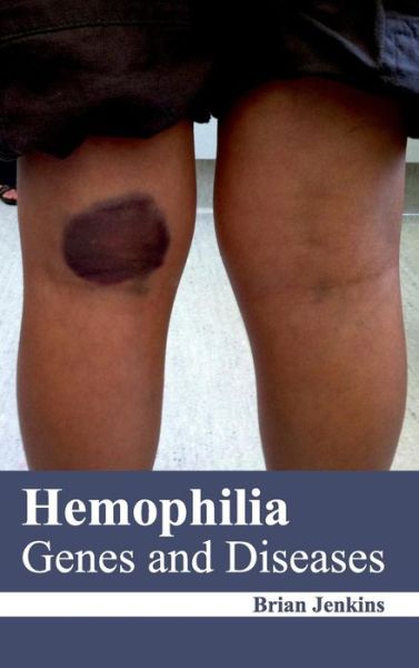 Cover for Brian Jenkins · Hemophilia: Genes and Diseases (Hardcover Book) (2015)