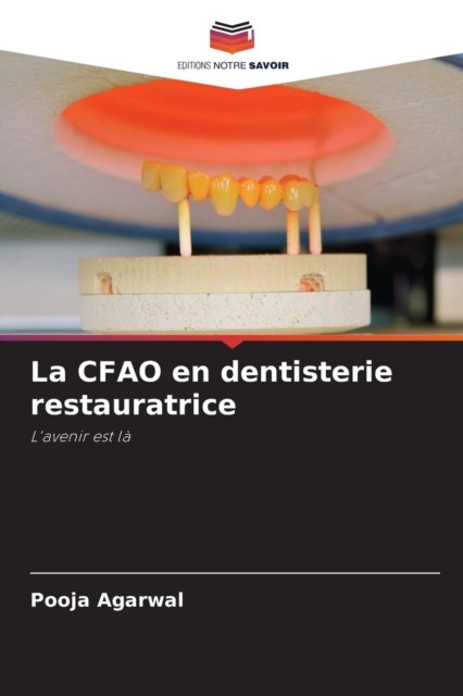 Cover for Pooja Agarwal · La CFAO en dentisterie restauratrice (Taschenbuch) (2021)