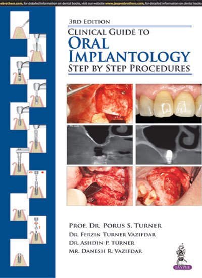Cover for Porus S Turner · Clinical Guide to Oral Implantology: Step by Step Procedures (Pocketbok) [3 Revised edition] (2018)