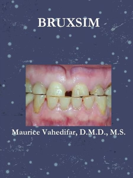 Cover for Vahedifar D M D M S Maurice · Bruxsim (Paperback Book) (2015)