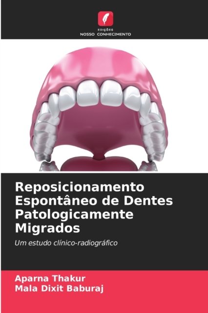Cover for Aparna Thakur · Reposicionamento Espontaneo de Dentes Patologicamente Migrados (Paperback Bog) (2021)