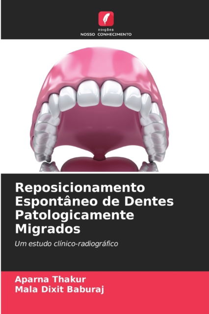 Cover for Aparna Thakur · Reposicionamento Espontaneo de Dentes Patologicamente Migrados (Paperback Book) (2021)