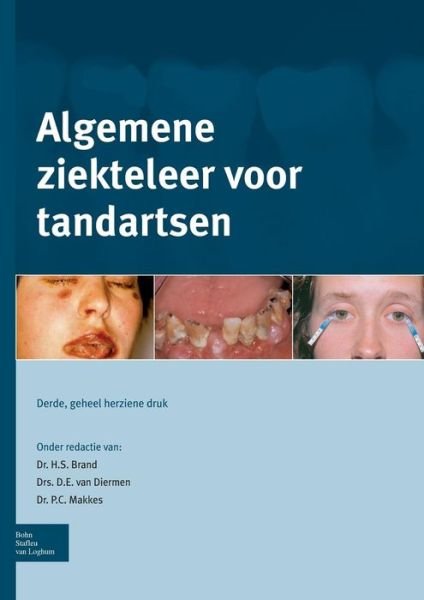 Algemene Ziekteleer Voor Tandartsen - H S Brand - Bøker - Bohn Stafleu Van Loghum - 9789031387281 - 20. februar 2012