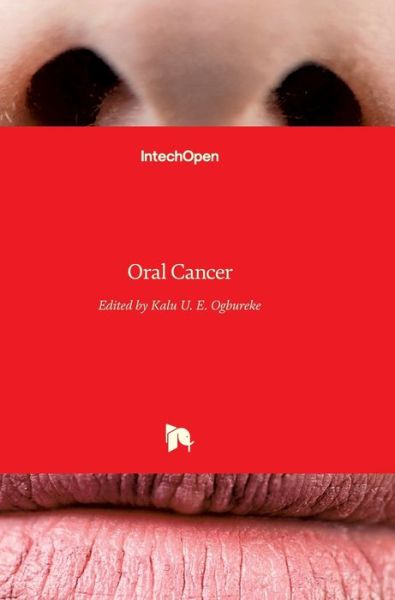 Cover for Kalu U E Ogbureke · Oral Cancer (Hardcover Book) (2012)