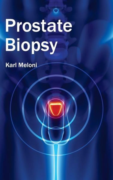 Cover for Karl Meloni · Prostate Biopsy (Hardcover Book) (2015)