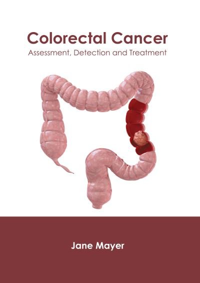 Cover for Jane Mayer · Colorectal Cancer: Assessment, Detection and Treatment (Hardcover bog) (2020)