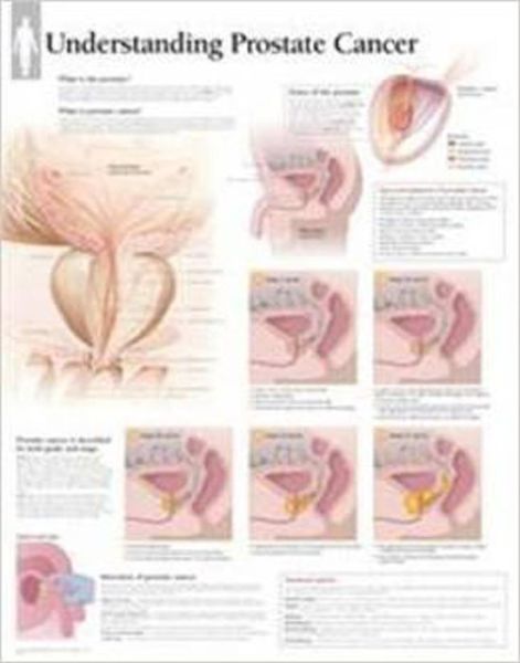 Cover for Scientific Publishing · Understanding Prostate Cancer Paper Poster (Kartor) (2013)