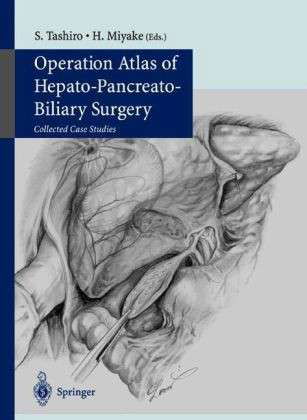 Operation Atlas of Hepato-pancreato-biliary Surgery: Collected Case Studies (Softcover Reprint of the Origi) - S Tashiro - Książki - Springer - 9784431670285 - 20 listopada 2013