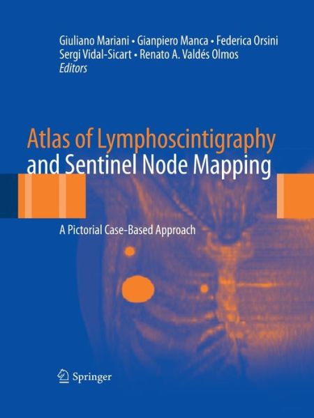 Atlas of Lymphoscintigraphy and Sentinel Node Mapping: A Pictorial Case-Based Approach - - Bøger - Springer Verlag - 9788847039285 - 23. august 2016