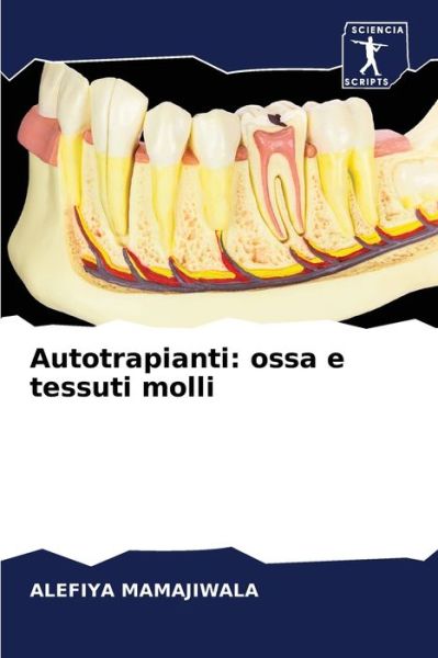 Cover for Alefiya Mamajiwala · Autotrapianti (Paperback Book) (2021)