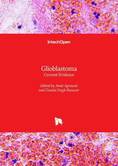 Cover for Glioblastoma: Current Evidence (Innbunden bok) (2023)