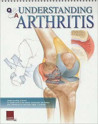 Cover for Scientific Publishing · Understanding Arthritis Flip Chart (Spiralbuch) (2006)