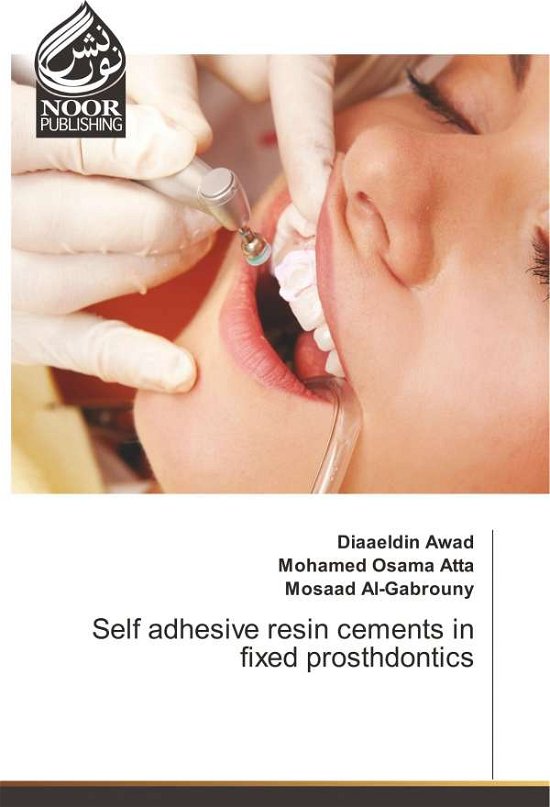 Cover for Awad · Self adhesive resin cements in fix (Bok)