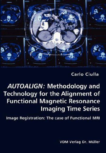 Cover for Carlo Ciulla · Autoalign: Methodology and Technology for the Alignment of Functional Magnetic Resonance Imaging Time Series (Paperback Book) (2008)