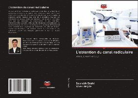 Cover for Doshi · L'obtention du canal radiculaire (Book)