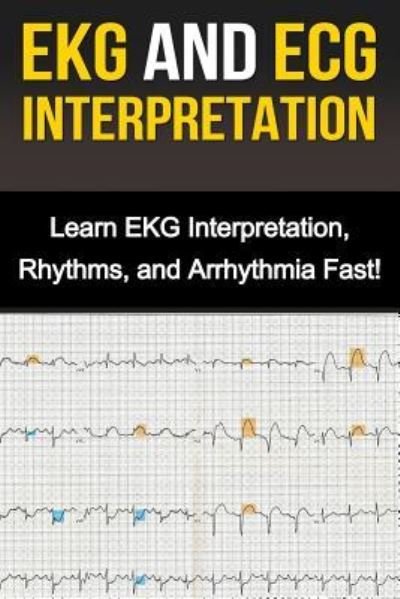 Cover for Alyssa Stone · EKG and ECG Interpretation (Paperback Book) (2015)