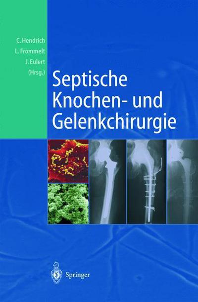 Cover for Christian Hendrich · Septische Knochen-Und Gelenkchirurgie (Paperback Book) [Softcover Reprint of the Original 1st 2004 edition] (2012)