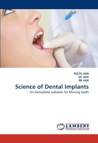 Science of Dental Implants: an Immediate Solution for Missing Teeth - Rb Jain - Bøker - LAP LAMBERT Academic Publishing - 9783844321289 - 28. mars 2011