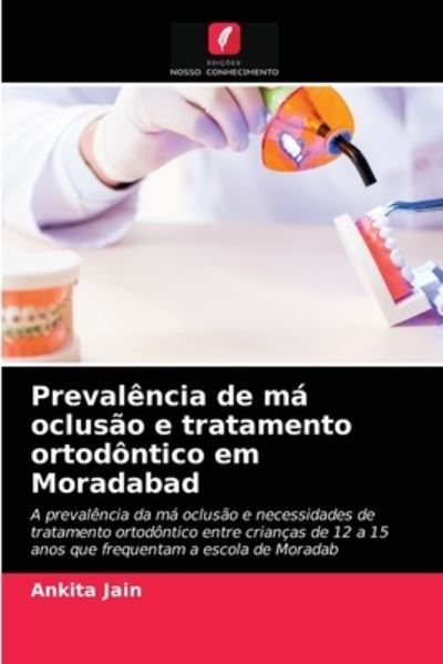 Cover for Ankita Jain · Prevalencia de ma oclusao e tratamento ortodontico em Moradabad (Pocketbok) (2021)