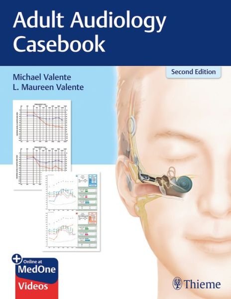 Adult Audiology Casebook - Michael Valente - Kirjat - Thieme Medical Publishers Inc - 9781626237292 - keskiviikko 8. huhtikuuta 2020
