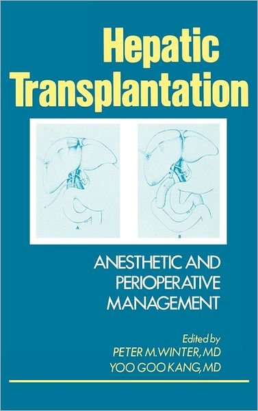 Cover for Yoo Goo Kang · Hepatic Transplantation: Anesthetic and Perioperative Management (Hardcover bog) (1986)