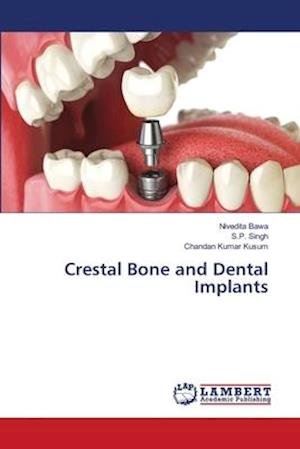 Cover for Bawa · Crestal Bone and Dental Implants (Bog) (2018)