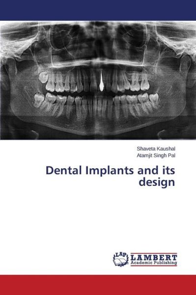 Cover for Atamjit Singh Pal · Dental Implants and Its Design (Paperback Book) (2014)