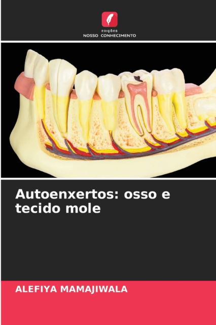 Cover for Alefiya Mamajiwala · Autoenxertos (Paperback Book) (2021)
