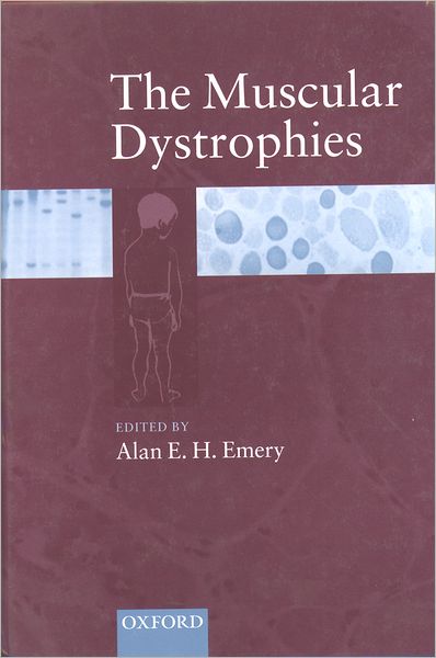 Cover for Jones, Peter (, Director, Northern Regional Haemophilia Service, Royal Victoria Infirmary, Newcastle upon Tyne) · Living with Haemophilia (Paperback Book) [5 Revised edition] (2002)