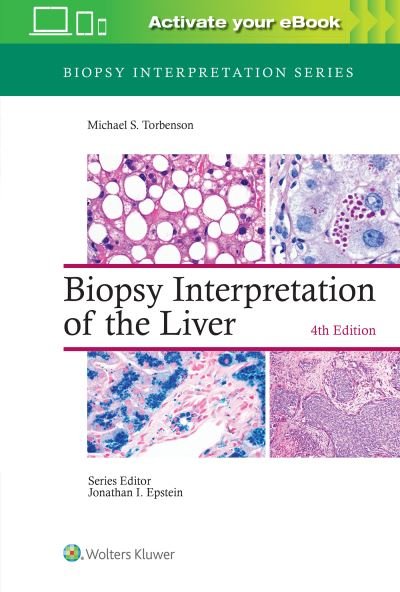 Cover for Torbenson, Michael, MD · Biopsy Interpretation of the Liver - Biopsy Interpretation Series (Gebundenes Buch) (2021)