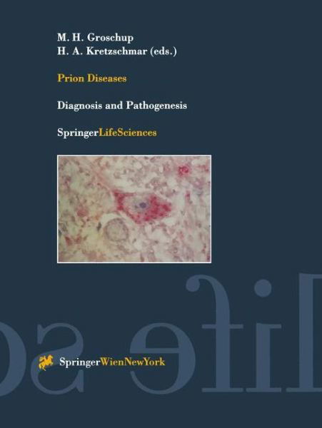 Cover for M H Groschup · Prion Diseases: Diagnosis and Pathogenesis - Archives of Virology. Supplementa (Paperback Book) [Softcover reprint of the original 1st ed. 2000 edition] (2000)