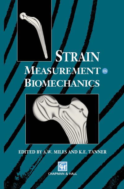 Strain Measurement in Biomechanics - A W Miles - Kirjat - Springer - 9789401050296 - torstai 27. syyskuuta 2012