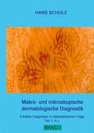 Cover for Hans Schulz · Makro- und mikroskopische dermatologische Diagnostik (Paperback Book) (2021)