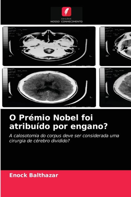 Cover for Enock Balthazar · O Premio Nobel foi atribuido por engano? (Paperback Book) (2021)