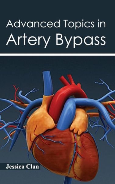 Cover for Jessica Clan · Advanced Topics in Artery Bypass (Gebundenes Buch) (2015)