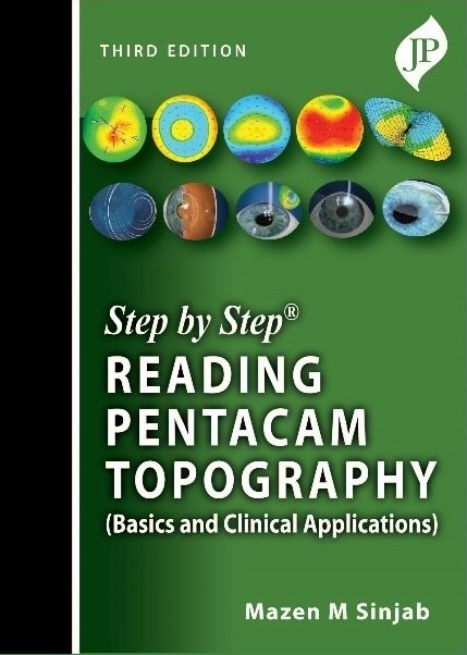 Cover for Mazen M Sinjab · Step by Step: Reading Pentacam Topography: Basics and Clinical Applications (Taschenbuch) [3 Revised edition] (2020)